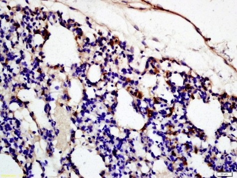 Immunohistochemistry (Formalin/PFA-fixed paraffin-embedded sections) - Anti-C3c antibody (AB204121)