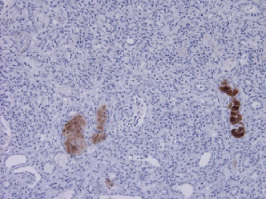 Immunohistochemistry - Anti-C3d antibody [7C10] (AB17453)