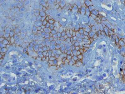Immunohistochemistry (Formalin/PFA-fixed paraffin-embedded sections) - Anti-C3d antibody [E28-P] (AB136916)