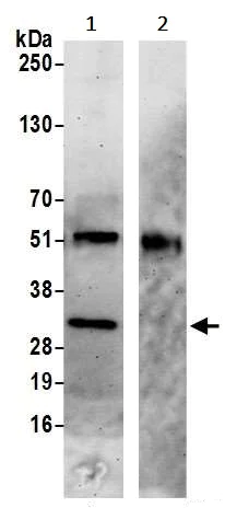 Immunoprecipitation - Anti-C3orf26 antibody (AB241582)