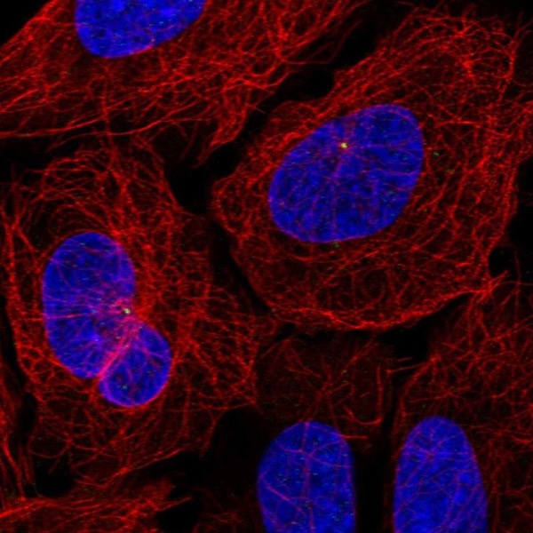 Immunocytochemistry/ Immunofluorescence - Anti-C3Orf34 antibody (AB221816)