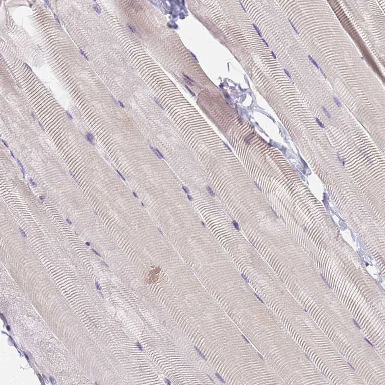 Immunohistochemistry (Formalin/PFA-fixed paraffin-embedded sections) - Anti-C3orf37 antibody (AB272646)