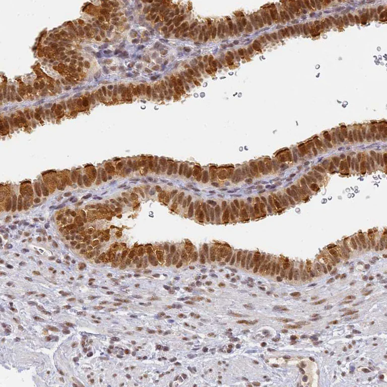 Immunohistochemistry (Formalin/PFA-fixed paraffin-embedded sections) - Anti-C3orf37 antibody (AB272646)