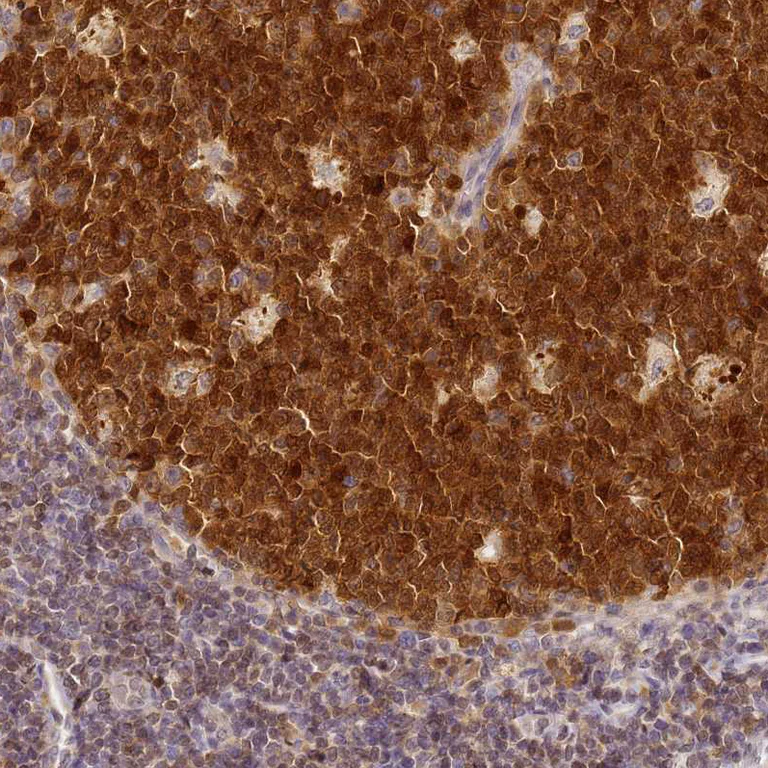 Immunohistochemistry (Formalin/PFA-fixed paraffin-embedded sections) - Anti-C3orf37 antibody (AB272646)