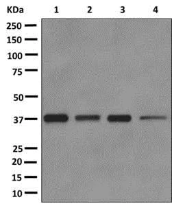 Western blot - Anti-C3orf38 antibody [EPR12512] - BSA and Azide free (AB249699)