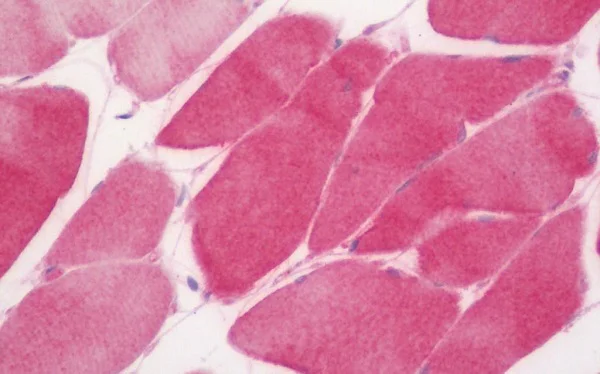 Immunohistochemistry (Formalin/PFA-fixed paraffin-embedded sections) - Anti-C3orf43 antibody [1H6] (AB230681)