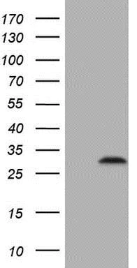 Western blot - Anti-C3orf43 antibody [1H6] (AB230681)