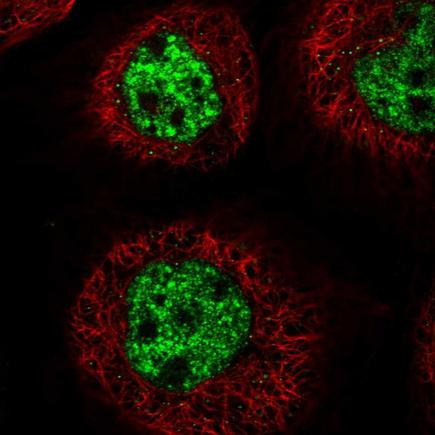 Immunocytochemistry/ Immunofluorescence - Anti-C3ORF62 antibody (AB243534)