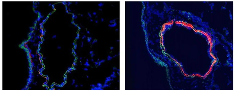 Immunohistochemistry (Frozen sections) - Anti-C4 antibody [16D2] (AB11863)