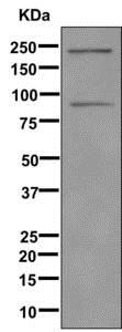 Western blot - Anti-C4 antibody [EPR2990(2)] (AB173577), expandable thumbnail