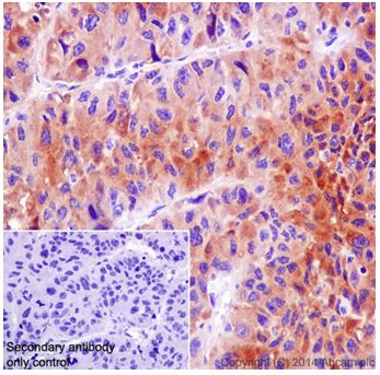 Immunohistochemistry (Formalin/PFA-fixed paraffin-embedded sections) - Anti-C4 binding protein/C4BPB antibody [EPR17101] - BSA and Azide free (AB251274), expandable thumbnail