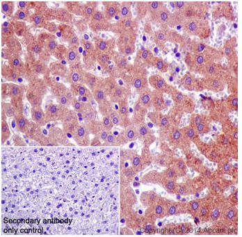 Immunohistochemistry (Formalin/PFA-fixed paraffin-embedded sections) - Anti-C4 binding protein/C4BPB antibody [EPR17101] - BSA and Azide free (ab251274), expandable thumbnail