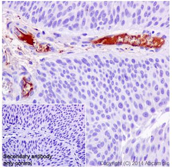 Immunohistochemistry (Formalin/PFA-fixed paraffin-embedded sections) - Anti-C4 binding protein/C4BPB antibody [EPR17101] - BSA and Azide free (AB251274), expandable thumbnail