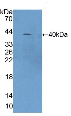 Western blot - Anti-C4a antibody (AB231090), expandable thumbnail