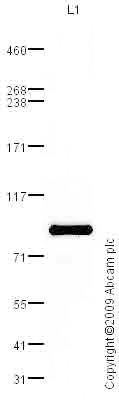 Western blot - Anti-C4a antibody (AB87429)