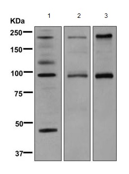Western blot - Anti-C4b antibody [EPR11203] - BSA and Azide free (AB249454), expandable thumbnail