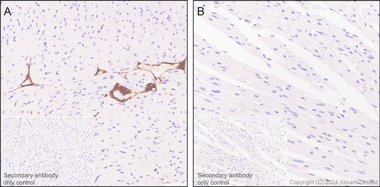 Immunohistochemistry (Formalin/PFA-fixed paraffin-embedded sections) - Anti-C4b antibody [EPR28966-89] - BSA and Azide free (AB324801)