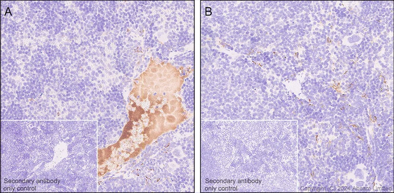 Immunohistochemistry (Formalin/PFA-fixed paraffin-embedded sections) - Anti-C4b antibody [EPR28966-89] - BSA and Azide free (AB324801)