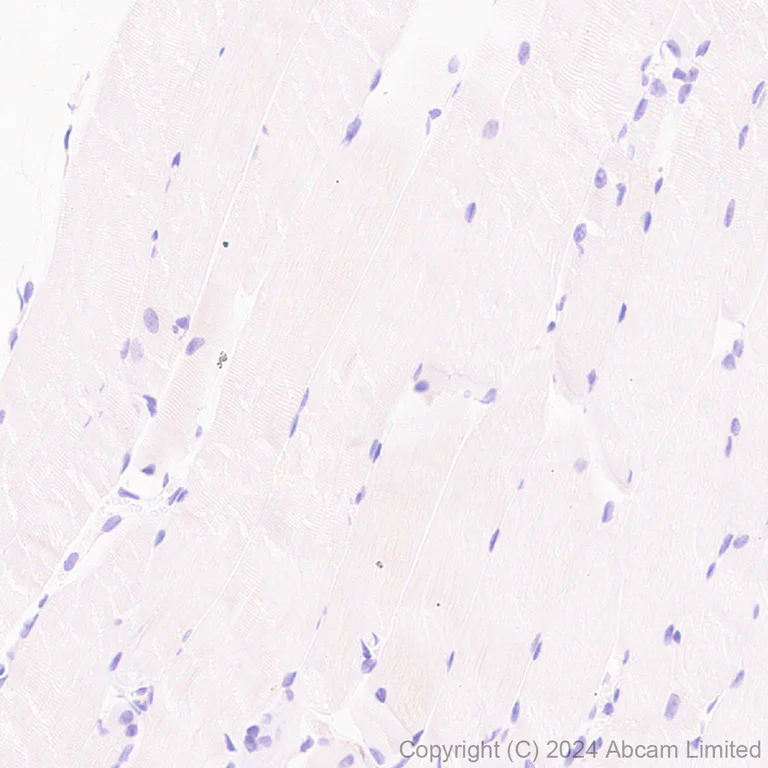 Immunohistochemistry (Formalin/PFA-fixed paraffin-embedded sections) - Anti-C4b antibody [EPR28966-89] - BSA and Azide free (AB324801)