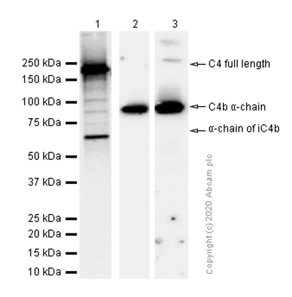 Western blot - Anti-C4B-d / C4B-b antibody [EPR11203-27] (AB181241)