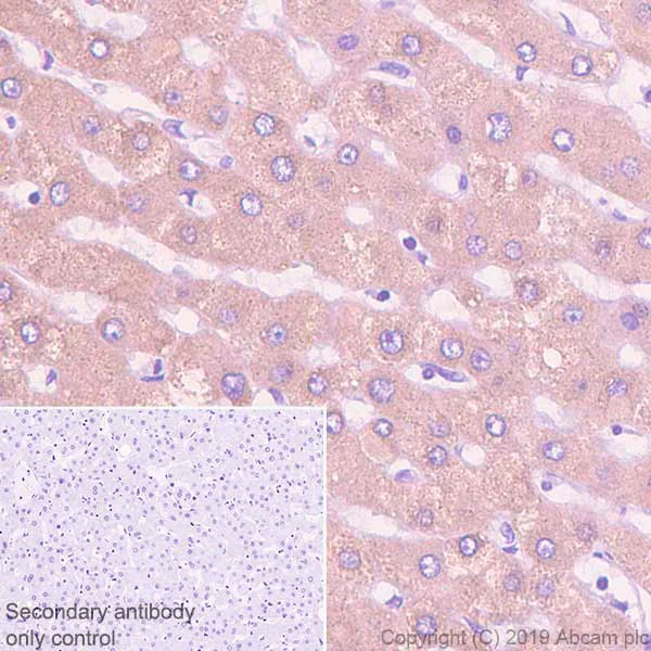 Immunohistochemistry (Formalin/PFA-fixed paraffin-embedded sections) - Anti-C4B-d / C4B-b antibody [EPR11203-27] - BSA and Azide free (AB250455)