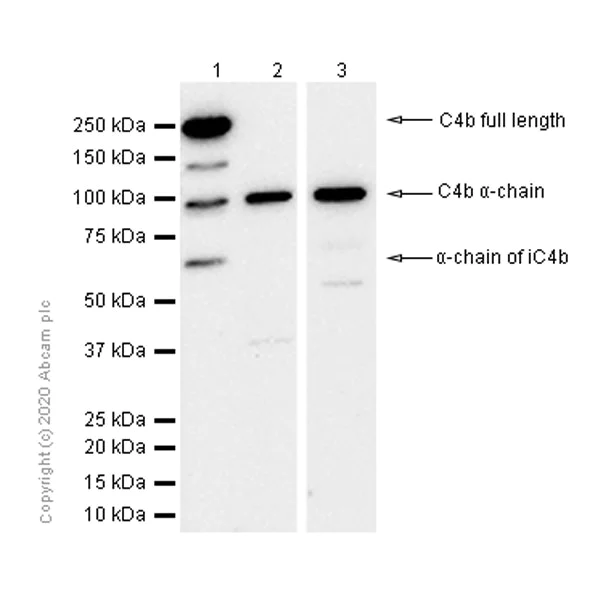 Western blot - Anti-C4B-d / C4B-b antibody [EPR11203-27] - BSA and Azide free (AB250455)