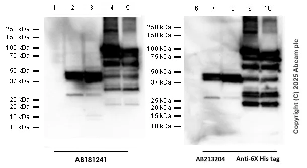 Western blot - Anti-C4B-d / C4B-b antibody [EPR11203-27] - BSA and Azide free (AB250455)