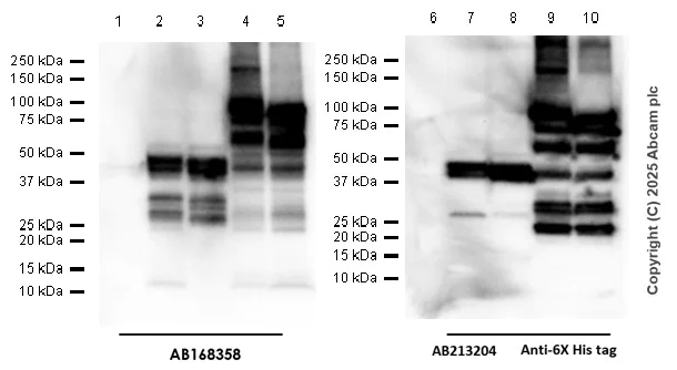 Western blot - Anti-C4B-d / C4B-b antibody [EPR11203] - BSA and Azide free (AB249454)