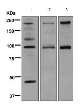 Western blot - Anti-C4B-d / C4B-b antibody [EPR11203] - BSA and Azide free (AB249454)