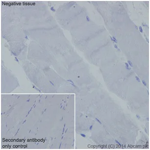 Immunohistochemistry (Formalin/PFA-fixed paraffin-embedded sections) - Anti-C4BPA antibody [EPR14780] (AB200345)