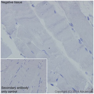 Immunohistochemistry (Formalin/PFA-fixed paraffin-embedded sections) - Anti-C4BPA antibody [EPR14780] - BSA and Azide free (AB251309), expandable thumbnail
