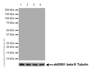 Western blot - Anti-C4BPA antibody [EPR14780] - BSA and Azide free (AB251309), expandable thumbnail