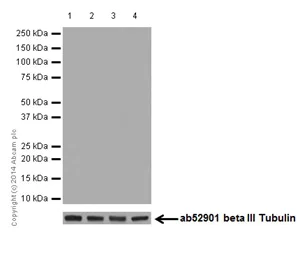 Western blot - Anti-C4BPA antibody [EPR14780] - BSA and Azide free (AB251309)