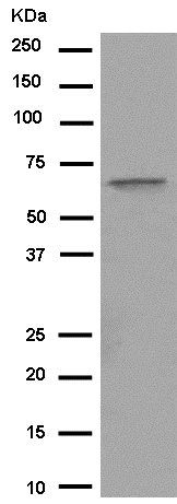 Western blot - Anti-C4BPA antibody [EPR14781(B)] - BSA and Azide free (AB250583)