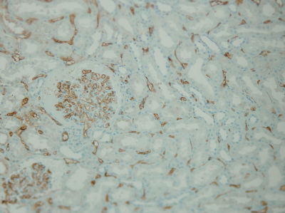 Immunohistochemistry (Formalin/PFA-fixed paraffin-embedded sections) - Anti-C4d antibody [A24-T] (AB136921), expandable thumbnail