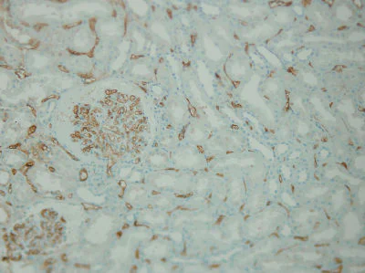 Immunohistochemistry (Formalin/PFA-fixed paraffin-embedded sections) - Anti-C4d antibody [A24-T] (AB136921)