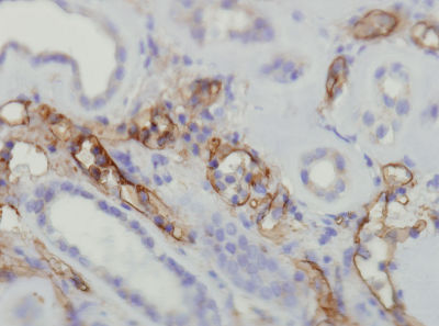 Immunohistochemistry (Formalin/PFA-fixed paraffin-embedded sections) - Anti-C4d antibody [A24-T] (AB136921), expandable thumbnail