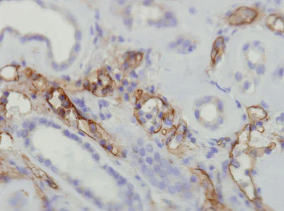 Immunohistochemistry (Formalin/PFA-fixed paraffin-embedded sections) - Anti-C4d antibody [A24-T] (AB136921)