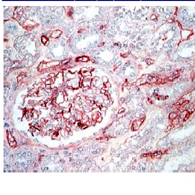 Immunohistochemistry (Formalin/PFA-fixed paraffin-embedded sections) - Anti-C4d antibody (AB36075)
