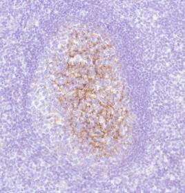 Immunohistochemistry (Formalin/PFA-fixed paraffin-embedded sections) - Anti-C4d antibody (AB74534)