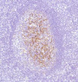 Immunohistochemistry (Formalin/PFA-fixed paraffin-embedded sections) - Anti-C4d antibody (AB74534)