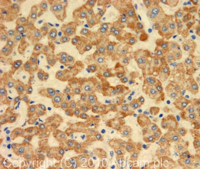 Immunohistochemistry (Formalin/PFA-fixed paraffin-embedded sections) - Anti-C4d antibody (AB87424), expandable thumbnail