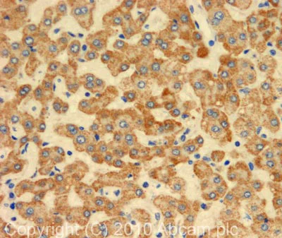 Immunohistochemistry (Formalin/PFA-fixed paraffin-embedded sections) - Anti-C4d antibody (AB87424)