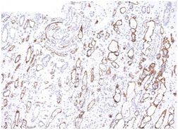 Immunohistochemistry (Formalin/PFA-fixed paraffin-embedded sections) - Anti-C4d antibody [C4D204] (AB187278)