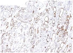 Immunohistochemistry (Formalin/PFA-fixed paraffin-embedded sections) - Anti-C4d antibody [C4D204] (AB187278)