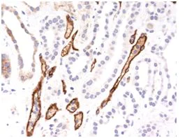 Immunohistochemistry (Formalin/PFA-fixed paraffin-embedded sections) - Anti-C4d antibody [C4D204] (AB187278)