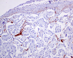 Immunohistochemistry (Formalin/PFA-fixed paraffin-embedded sections) - Anti-C4d antibody [EPR10143] (AB170942)