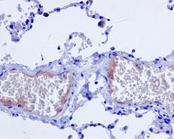 Immunohistochemistry (Formalin/PFA-fixed paraffin-embedded sections) - Anti-C4d antibody [EPR10143] (AB170942)