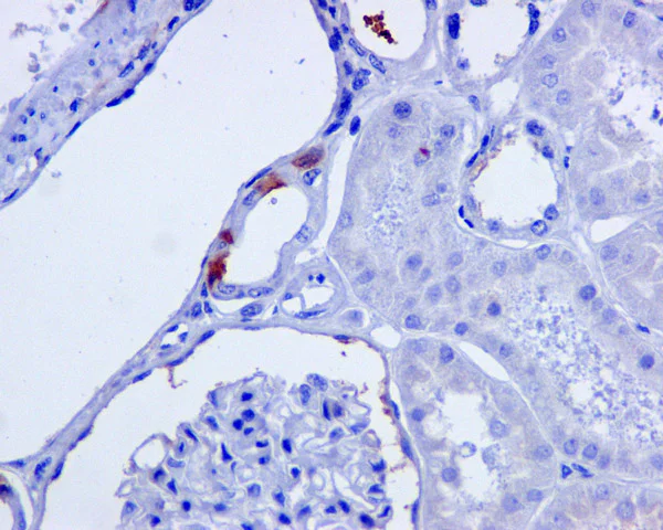Immunohistochemistry (Formalin/PFA-fixed paraffin-embedded sections) - Anti-C4d antibody [EPR10143] (AB170942)