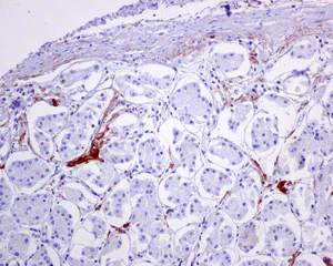 Immunohistochemistry (Formalin/PFA-fixed paraffin-embedded sections) - Anti-C4d antibody [EPR10143] - BSA and Azide free (AB249610)